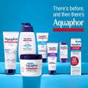 Aquaphor Children's Healing Ointment, Skin Protectant, 14oz Jar